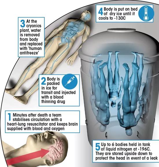 △冰冻人体过程示例